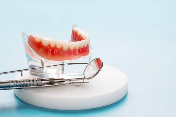 Full Mouth Reconstruction in Madison, MS